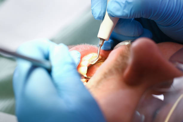 Best Mobile Emergency Dentist in Rutherford College, NC