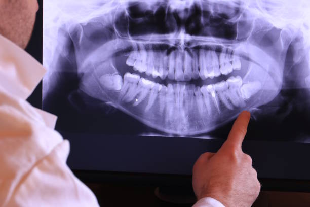 Best Emergency Dentist for Knocked-Out Tooth in Rutherford College, NC