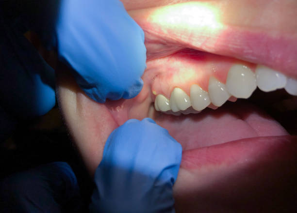 Best Holiday Emergency Dentist in Rutherford College, NC