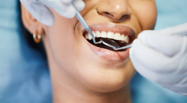 Best Emergency Dentist for Lost Fillings or Crowns in Rutherford College, NC