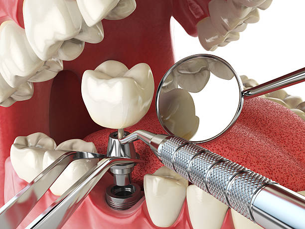 Best Urgent Dental Care for Toothache in Rutherford College, NC